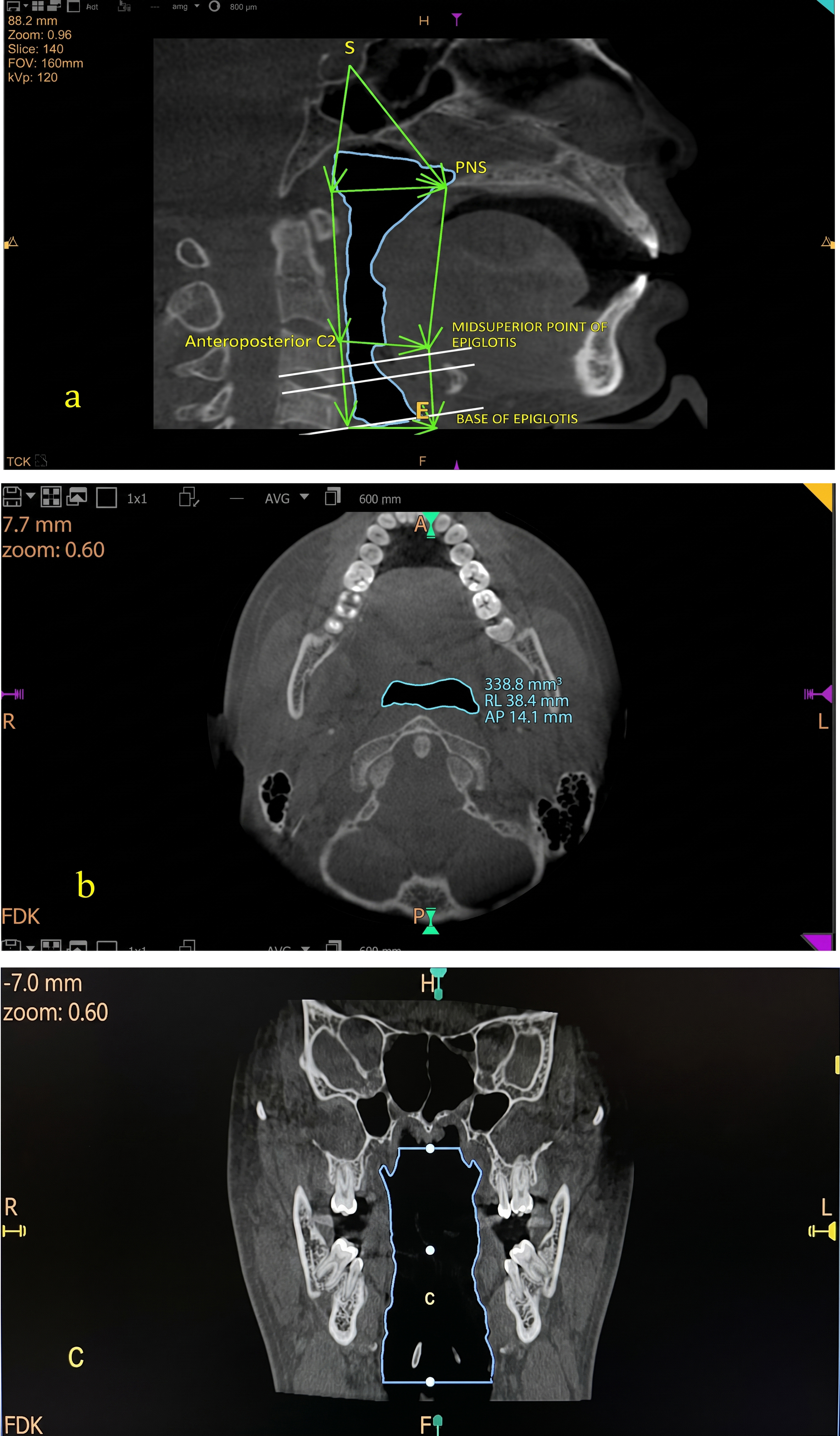 Fig. (1)